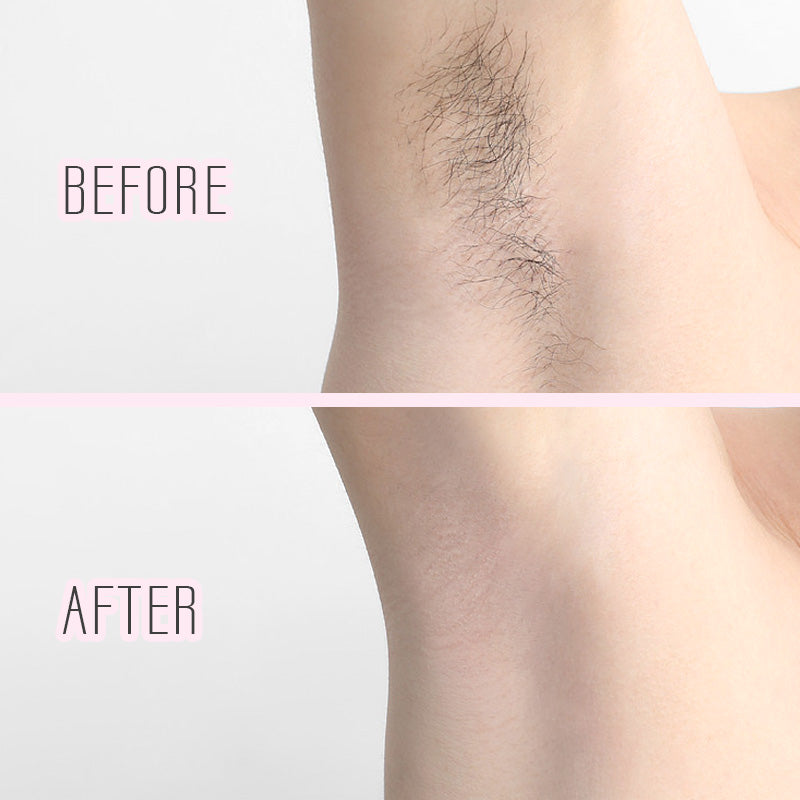 Women's Electric Shaver