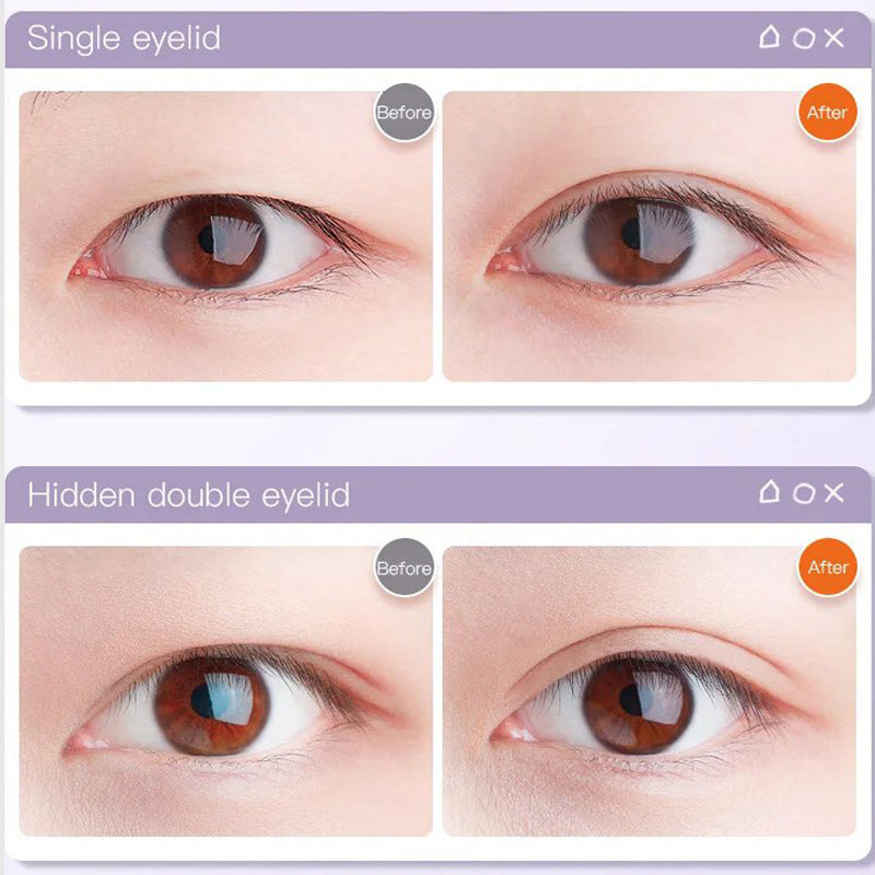 Invisible Self-Adhesive Eyelid Tape