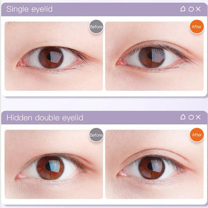 Invisible Self-Adhesive Eyelid Tape